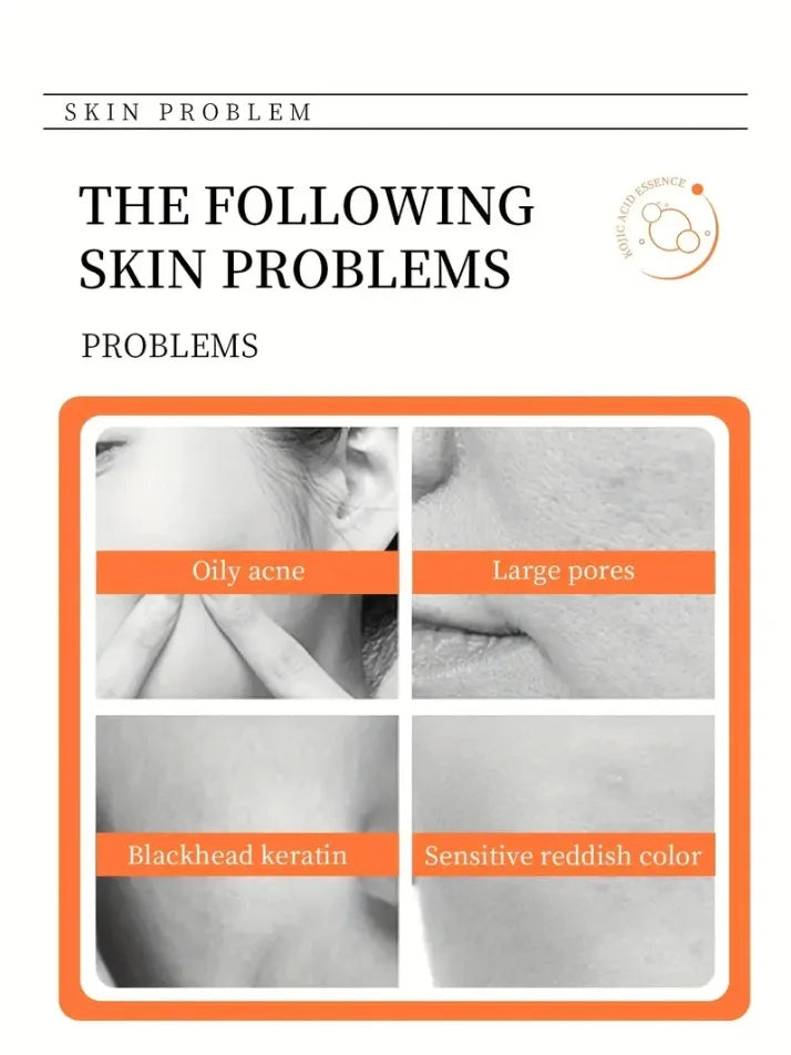 Kojic Acid Soap